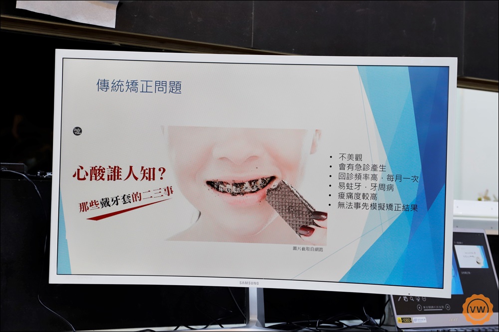 【隱適美矯正】矯正不拔牙，黃汝萍醫師 讓我感到讚嘆-台中光流牙醫